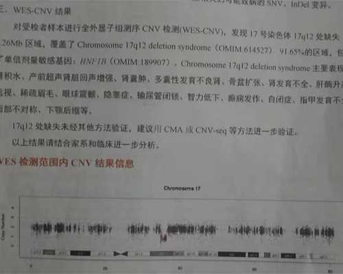 提取公积金到底有多难？