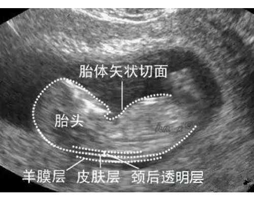 2026明星离婚文案——你学会（废）了吗？
